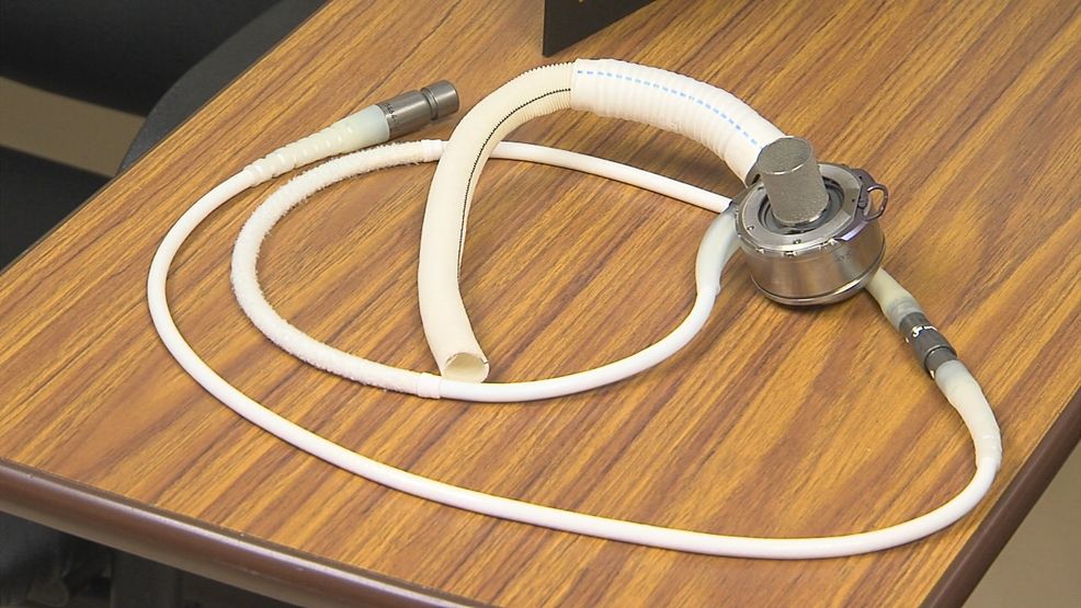 FDA Expands Use Of Heart Pumps, Thanks In Part To U Of R Research | WHAM