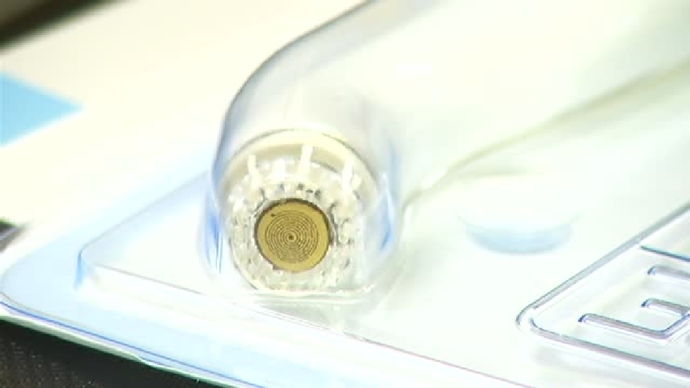 Health Check Margin Probe for breast cancer treatment WJAR