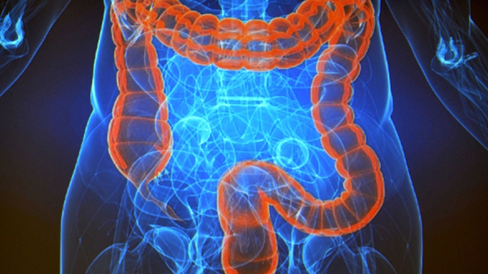 What You Need to Know: Colon Cancer Awareness Month 1280x720_60328P00-OPDDY.jpg